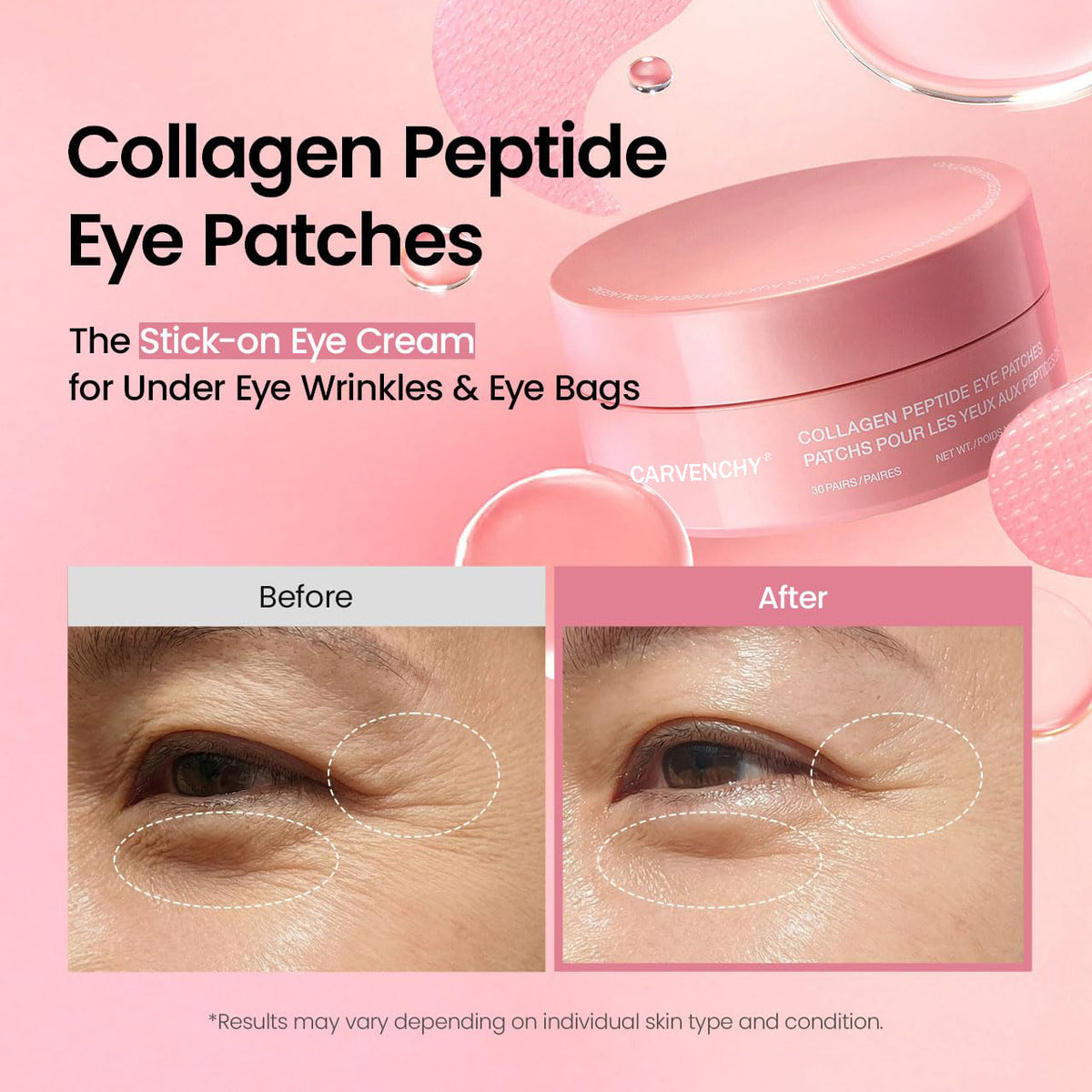 Collagen Peptide Eye Patches for Firming and Hydration